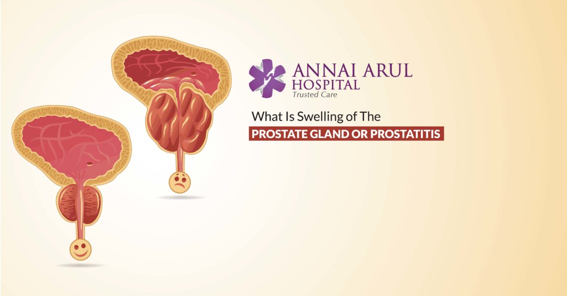 WHAT IS SWELLING OF THE PROSTATE GLAND OR PROSTATITIS