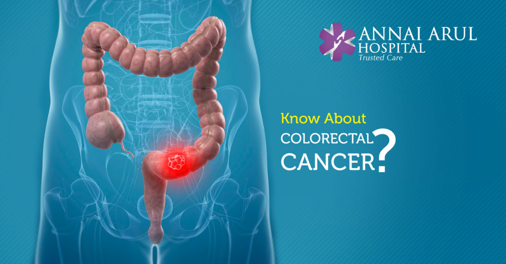 KNOW ABOUT COLORECTAL CANCER? Multispeciality Hospitals in Chennai