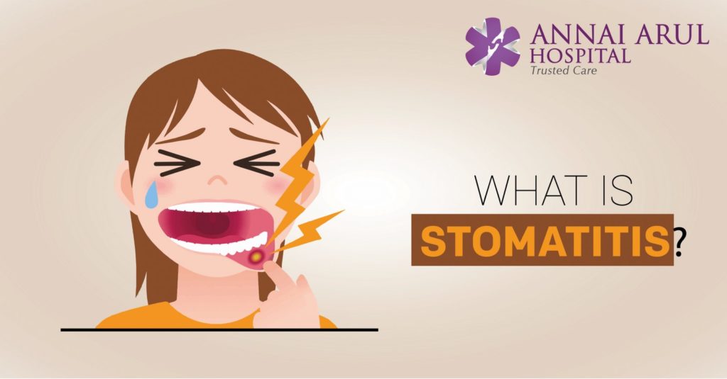 WHAT IS STOMATITIS? Multispeciality Hospitals in Chennai