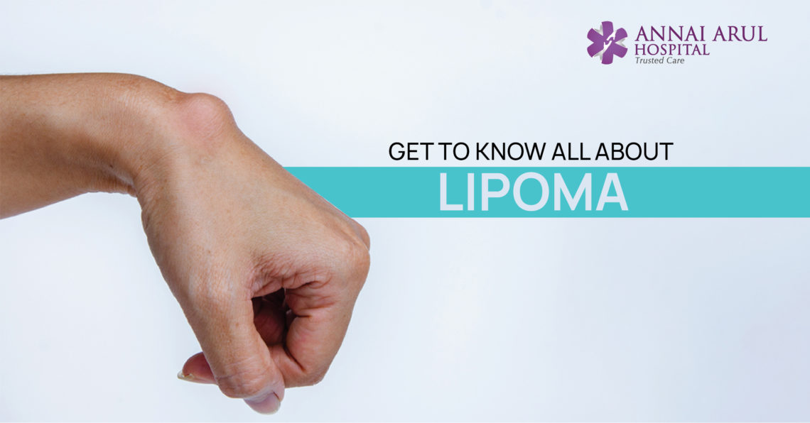 GET TO KNOW ALL ABOUT LIPOMA Multispeciality Hospitals in Chennai