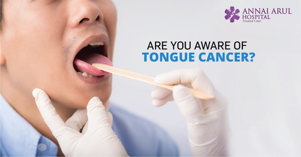 ARE YOU AWARE OF TONGUE CANCER? Multispeciality Hospitals in Chennai