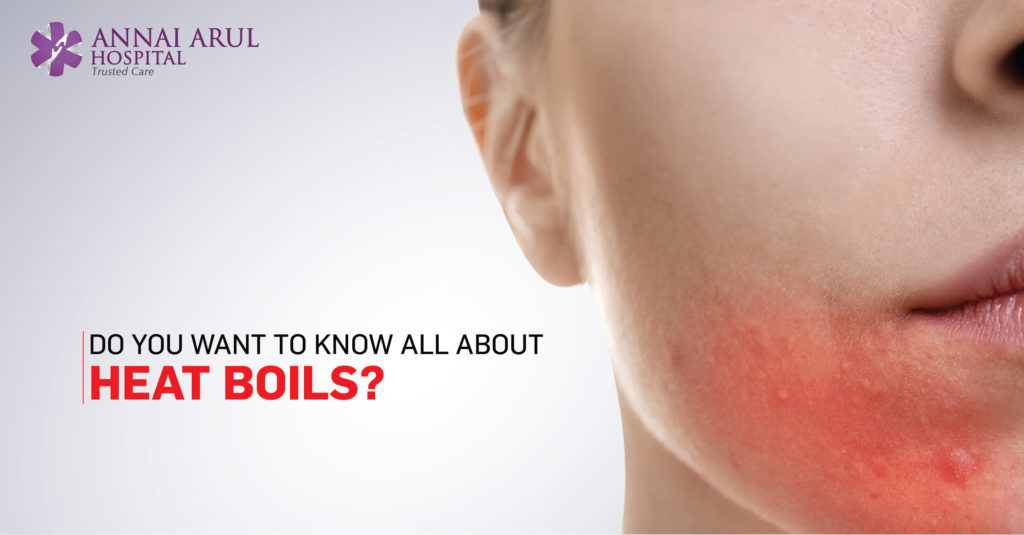 DO YOU WANT TO KNOW ALL ABOUT HEAT BOILS? Multispeciality Hospitals