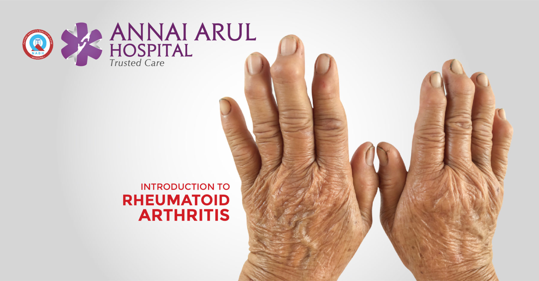new research of rheumatoid arthritis